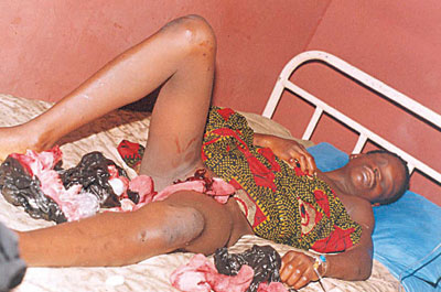 13-year-old girl in agony after attempted rape