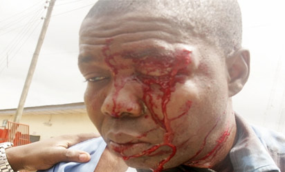 A Photojournalist with Leadership Newspaper, Benedict Uwalaka was beaten and brutalized by mortuary attendants at the Lagos State University Teaching Hospital (LASUTH)