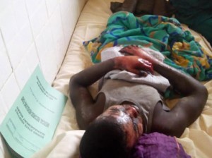 A victim of the attack in the hospital.