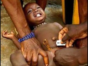 • Female circumcision has no known health benefit, yet it is still widely practiced in Nigeria and other African countries.