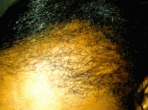 hair