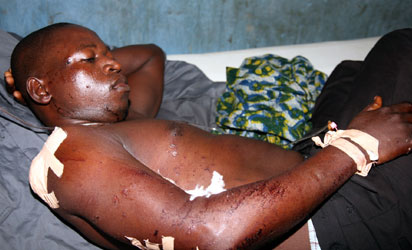ABUJA-BLAST-Victim