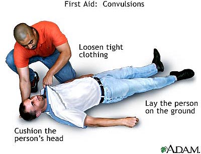 Convulsion can be controlled and it is not contagious - Vanguard News