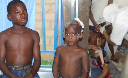 VICTIMS OF THE BOMB EXPLOSION AT ST. RITA’S CATHOLIC CHURCH, ANGWAN YERO, MALALI VILLAGE AT GARKUWAN HOSPITAL, IN KADUNA, ON SUNDAY.PHOTO;OLU AJAYI.
