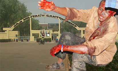 File Photo: one of the survived victims of Jaji bomb blast