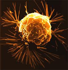 cancer cell Supplements to avoid to prevent prostate cancer