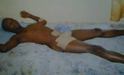 The victim, when he was first brought to the clinic