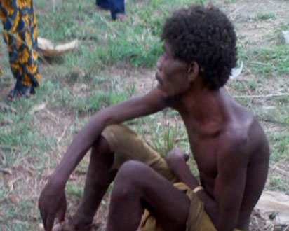 One of the rescued victims believed to have been bewitched and bound with fetters in a dungeon, in Soka, Oluyole local government area of Oyo State.