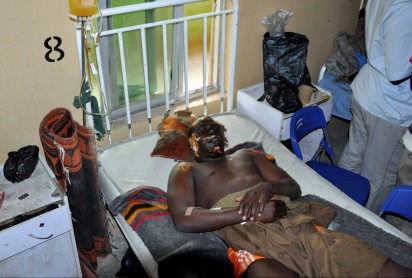 A man lies in state hospital bed as he receives treatment for injuries sustained following a bomb blast that left dozens dead and many injured in Maiduguri, on March 8, 2015. Three bombings in northeast Nigeria's largest city of Maiduguri killed 58 people on March 7, 2015 and wounded 139 others, the area police chief said. Niger and Chad on March 8, 2015 launched major ground and air strikes in northeast Nigeria against Boko Haram, after the militants formally pledged allegiance to the Islamic state group in Syria and Iraq. AFP PHOTO