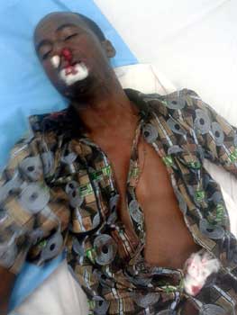 Mohammed Shuaibu, unconscious in hospital bed.