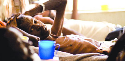 A TB patient on a hospital bed.