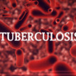 COVID-19 worsens TB cases in Nigeria – Director