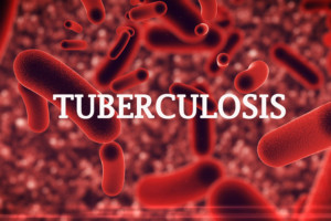 Ondo govt to embark on tuberculosis awareness campaign