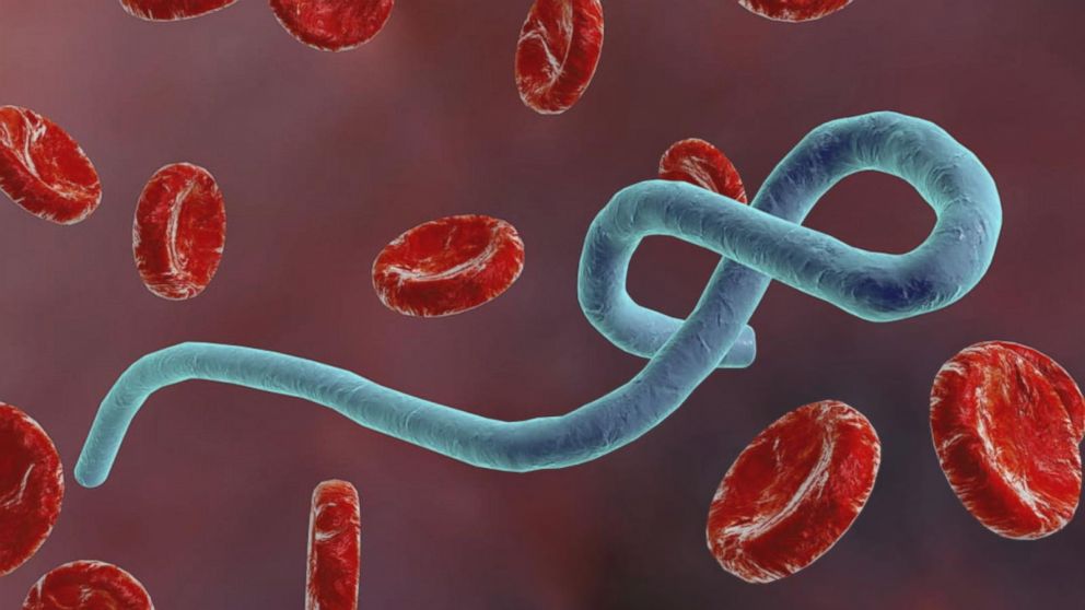 Improve case definition for Ebola, Expert urges FG