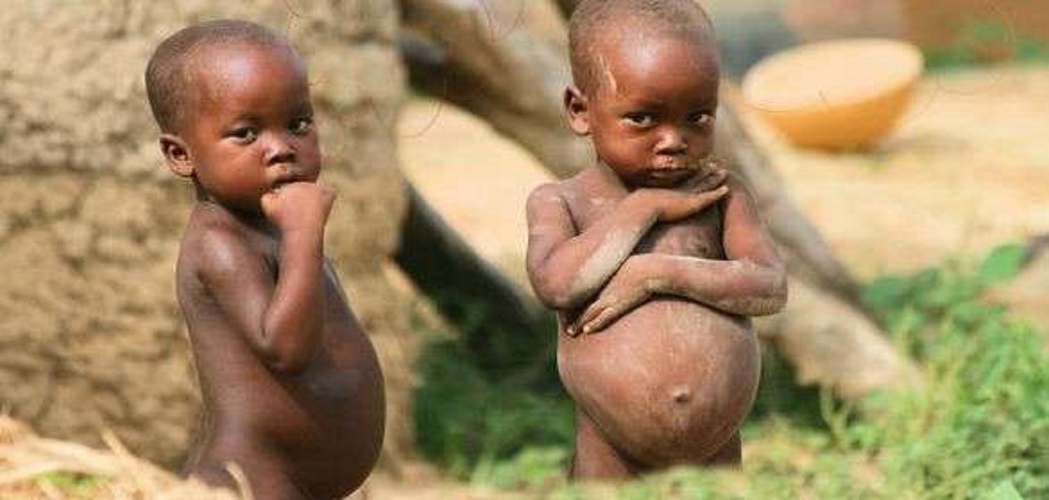 Children in three Plateau LGAs at risk of malnutrition, stunting