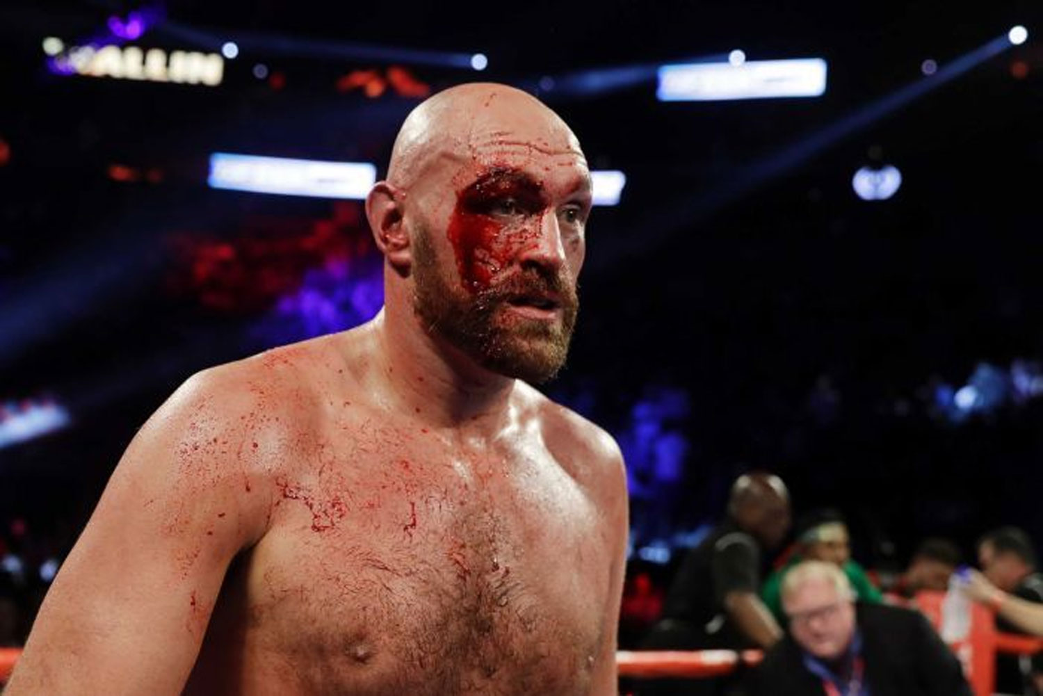 Tyson Fury, Anthony Joshua