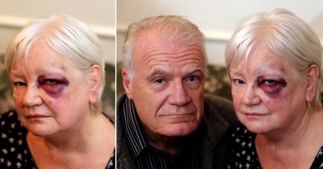 Pensioner attacked while handing out Christmas gifts to the homeless