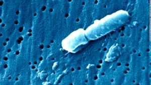 SARS-like virus