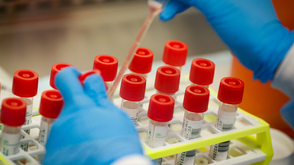 German pharmacists develop gargle test to detect coronavirus