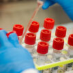 German pharmacists develop gargle test to detect coronavirus