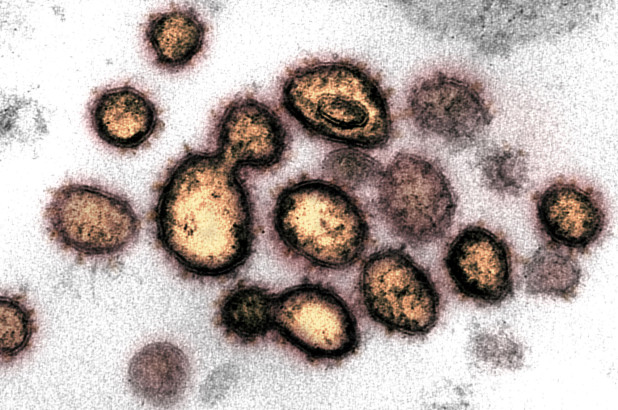 Fauci says coronavirus could claim up to 200,000 US lives
