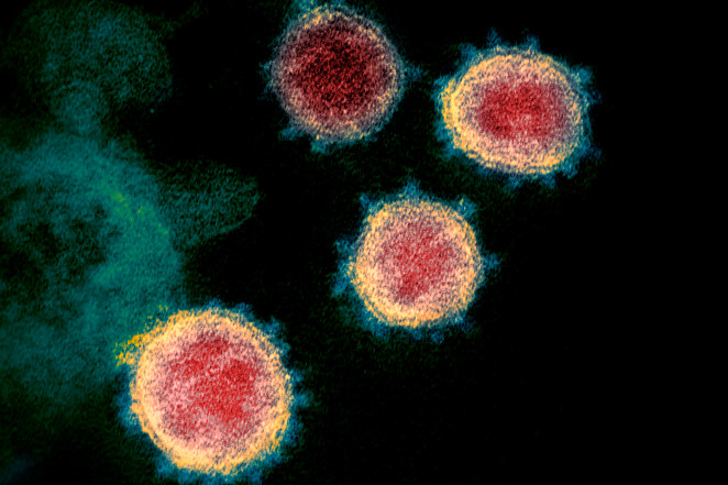 coronavirus