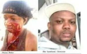 Landlord, wife slit tenant's face over unpaid rent in Lagos