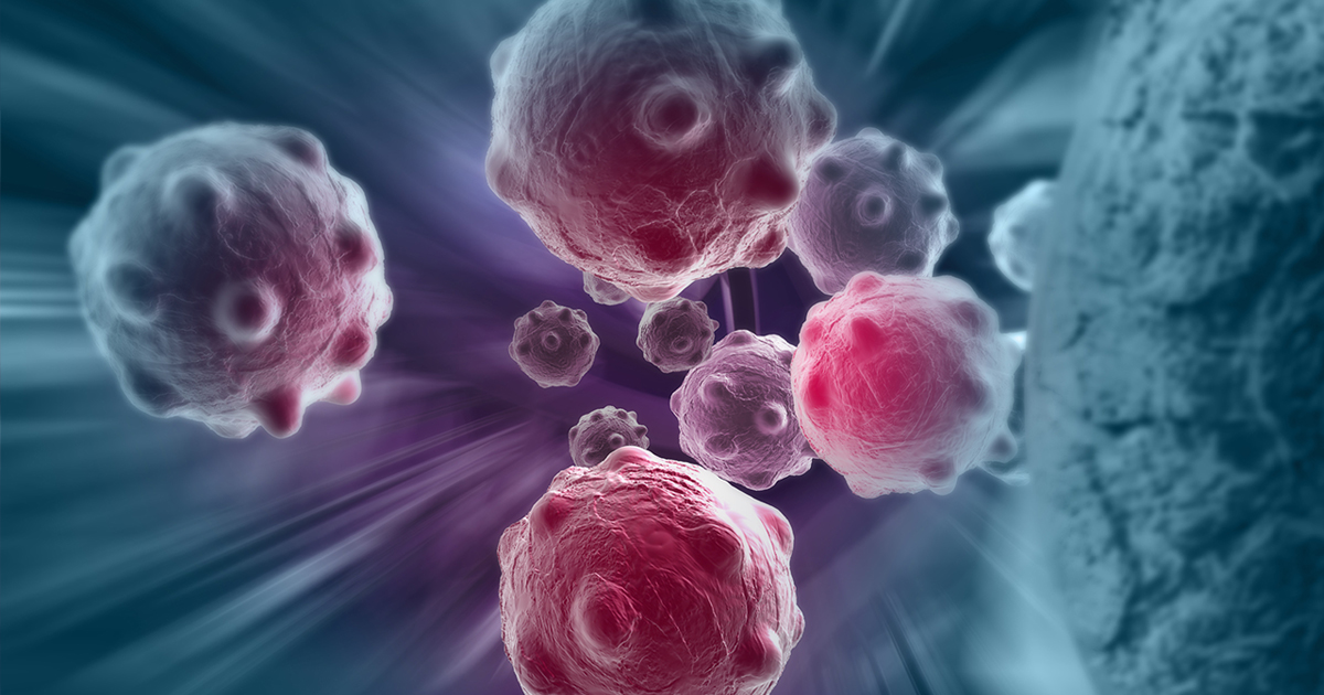 Amid COVID-19 2nd wave, experts worry over late presentation of cancer patients